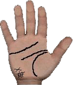 palmistry detection of kidney trouble