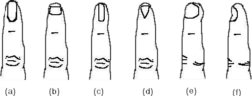 Various types of nails