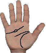 eye troubles in palmistry