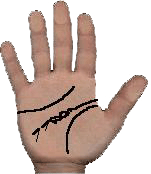mental illhealth in palm reading