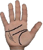 ulcers in palmistry