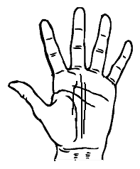 case of double fate line