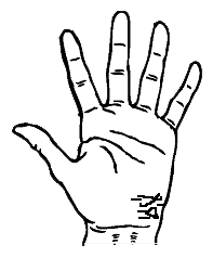 palmistry case of premature death